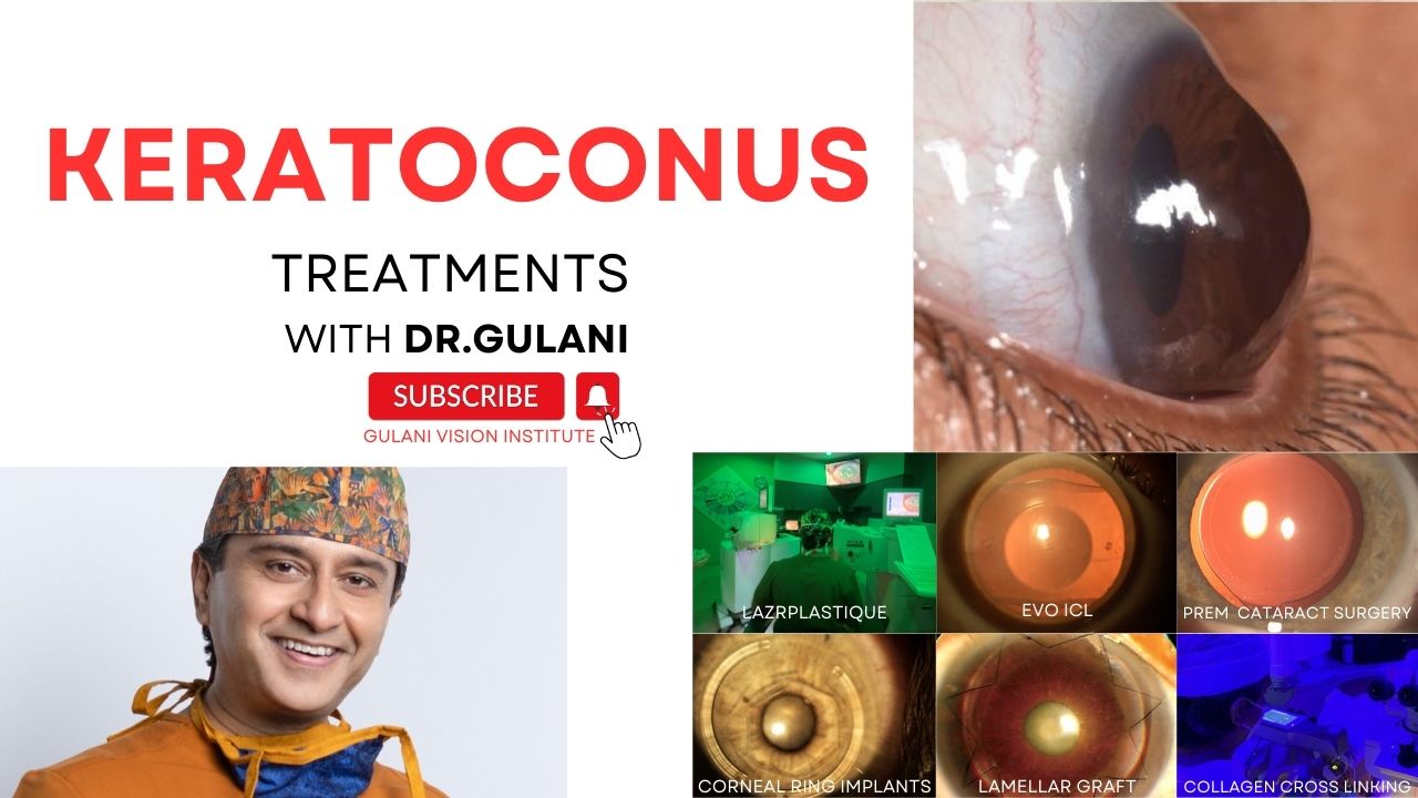 Keratoconus Correction