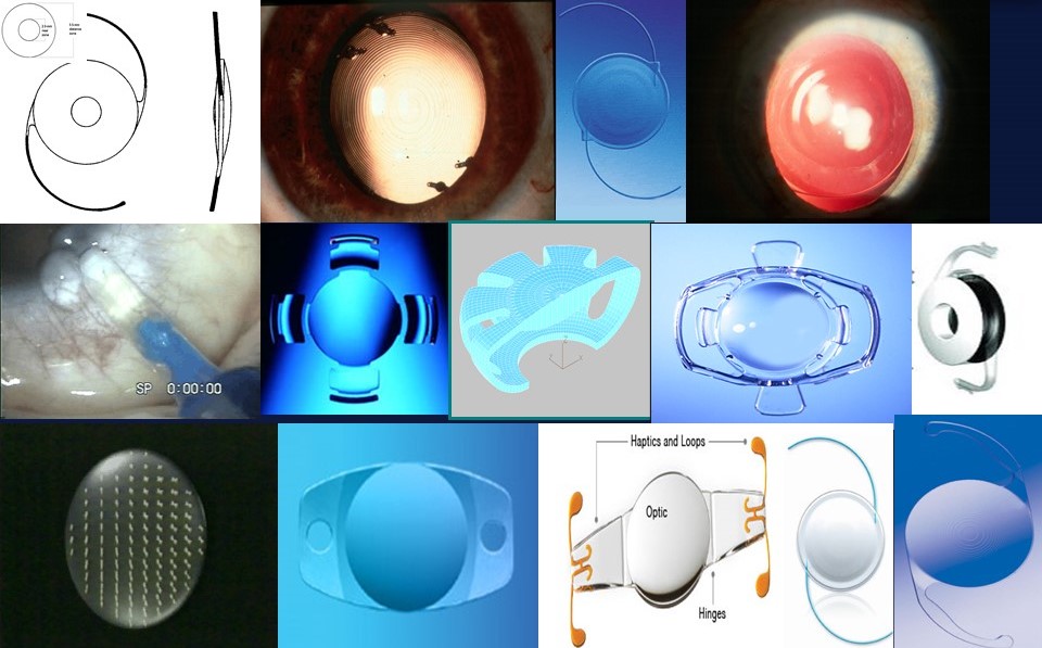 Presbyopia