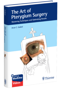 Before-and-after results of Dr. Arun Gulani’s advanced pinguecula surgery, demonstrating the transformation from red, irritated eyes to a clear, natural appearance using his SPARKLE™ technique